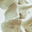 An image of a spine with the inside exposed represents osteoporosis.